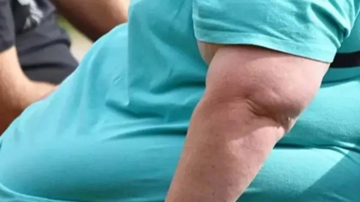 Kadınlarda obezitenin tetiklediği 8 ciddi sağlık sorunu