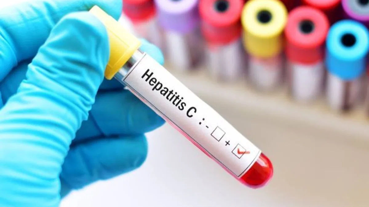 Hepatit C'nin gerçek yüzü!